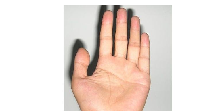 断掌的男人，男人断掌值千金