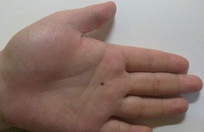 手上长痣面相图