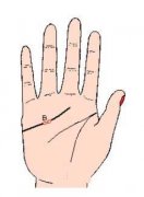 感情线上有岛纹什么意思