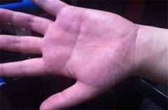 什么样的手相是“桃花掌”