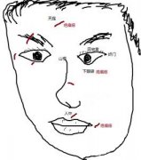 脸上疤痕和痣相对运气的影响