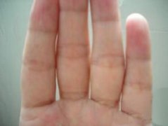 看看你是不是漏财手