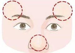 面相看你是否有横财可发？