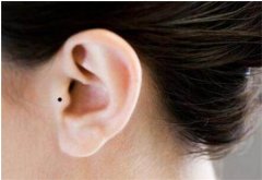 警惕面部疤痕痣对运势的影响