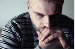 额头面相分析：额头宽大的面相好不好?