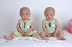 2016猴年男女双胞胎宝宝取名字大全