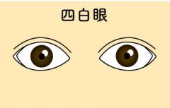 什么是四白眼，四白眼的人好吗？