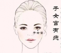 女人这五个部位长痣容易克夫