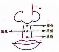 人中有痣好不好