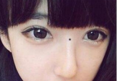 脸上哪儿长痣不好？从不同面相来看