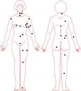 女人全身痣相图解