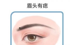 眉毛周围有痣是好还是坏