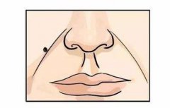 「面无善痣，方为贵」是真的吗