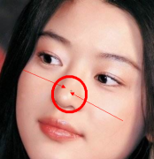 「痣」看命中运势，分析哪些是搜索小人的痣相，有限制的就点掉吗