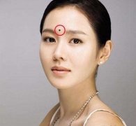 男脸痣的位置与命运_男脸痣代表什么