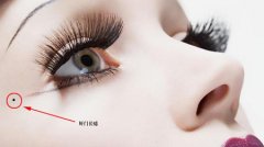 好坏四种痣，前者有钱有势，后者倒霉一生