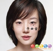 男人眼袋有痣代表什么