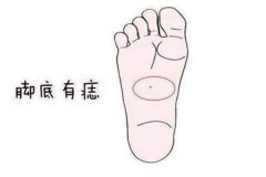 脚底有痣的男人的运势