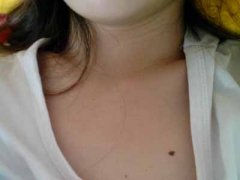 胸口前面有黑痣的人是富贵之命吗 胸口有痣未必胸有大志