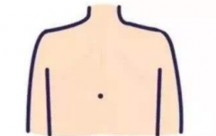 背中间突然长痣好不好