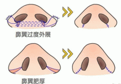 从鼻翼看出面相好坏