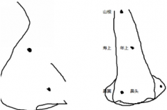 男人鼻子上长痣命运怎么样?