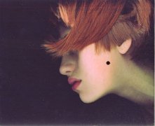 脸上的痣能随便点掉吗