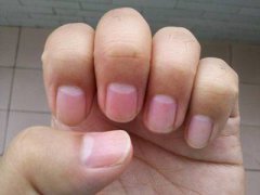 从5处看女人生育能力·体毛疯长不易受孕