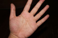 智慧线断掌有何意义？