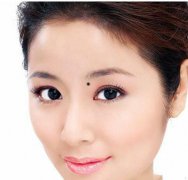 女人脸上痣代表富贵痣