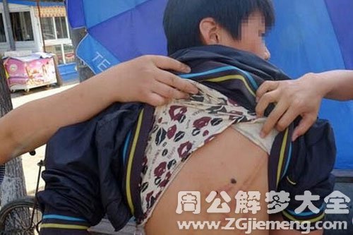 【梦见同学被打】