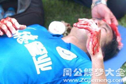 【梦见自己头上流血】