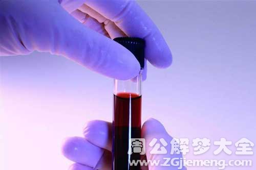 【梦见在医院抽血】