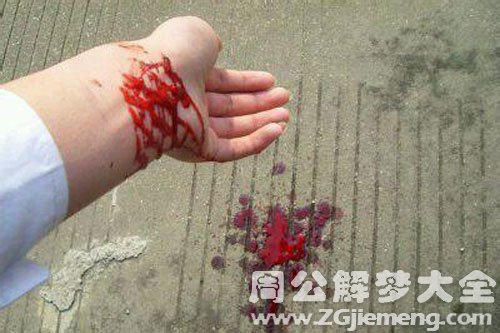 【梦见胳膊烂了】