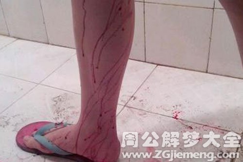 【梦见朋友怀孕流产了】