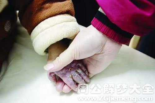 【梦见儿子被烧伤】