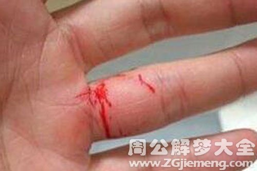 【梦见自己孩子流血】