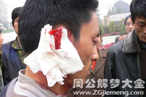 【梦见自己被砍流血】