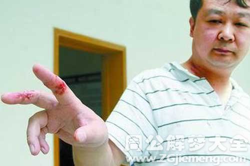 【梦见丈夫流血】