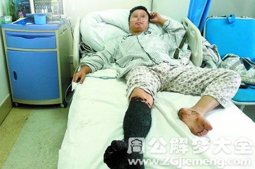 【女人梦见被蛇咬脚】