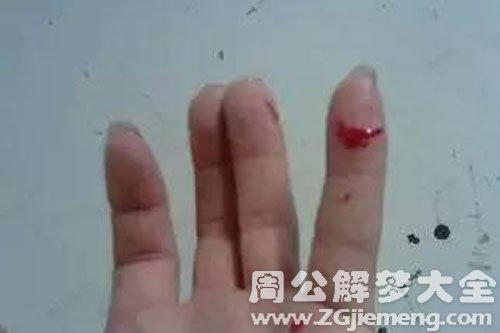 【梦见爸爸流血了】