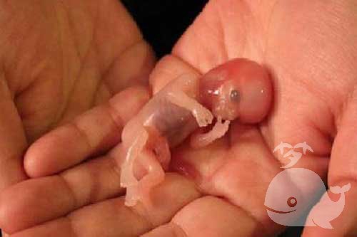 【梦见流产的孩子】