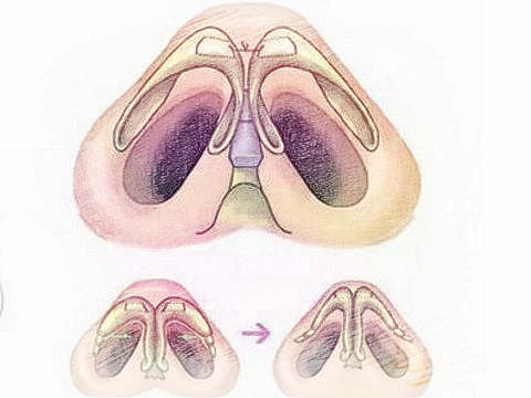 梦见鼻子、鼻孔　周公解梦之梦到鼻子、鼻孔