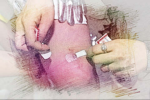 梦见大腿受伤　周公解梦之梦到大腿受伤