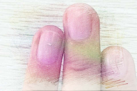 梦见指甲断裂　周公解梦之梦到指甲断裂