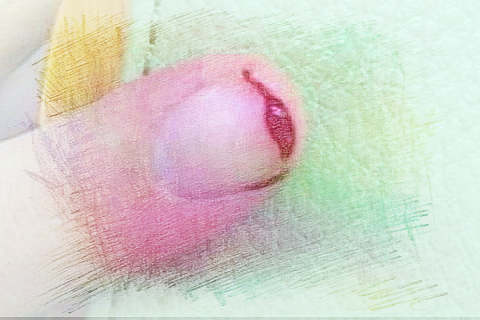 梦见指甲流血　周公解梦之梦到指甲流血