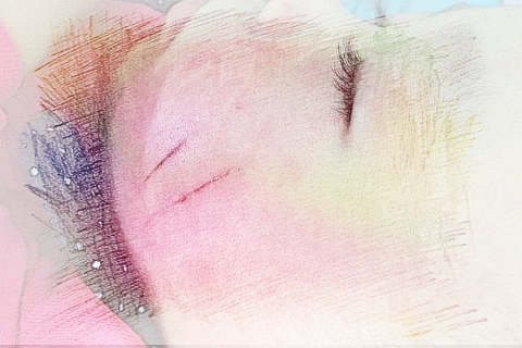 梦见脸被划伤　周公解梦之梦到脸被划伤