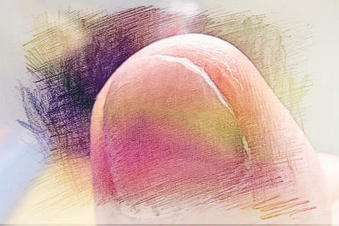 梦见灰指甲　周公解梦之梦到灰指甲