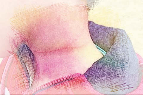 梦见脖子流血　周公解梦之梦到脖子流血