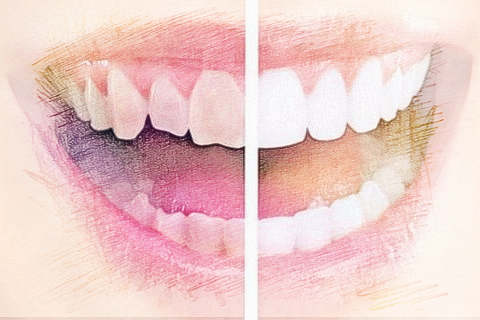 梦见牙齿变黑　周公解梦之梦到牙齿变黑